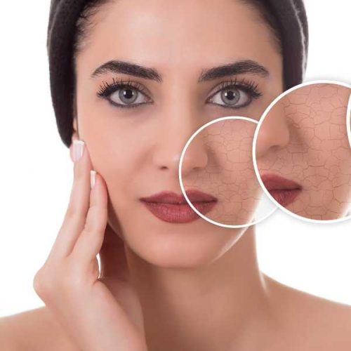 Lifting facial sin Cirugía Tratamiento para una Belleza Renovada