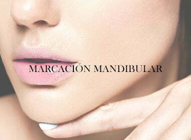 marcación mandibular medicina estética chamberí medicina estética madrid medico estético elena berezo