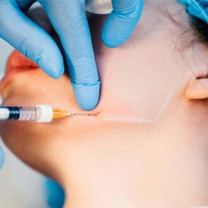 aumento de mentón sin cirugia medicina estética madrid