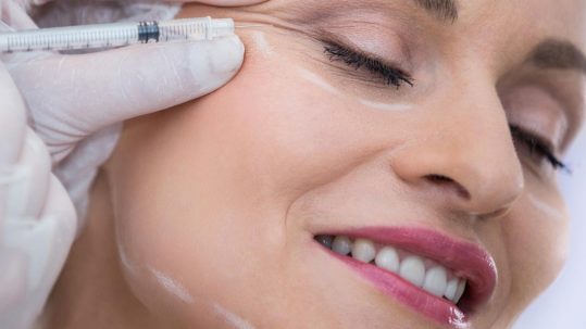 botox antes y después botox madrid