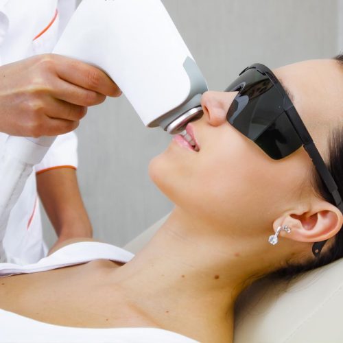 Lumenis m22 laser lumenis