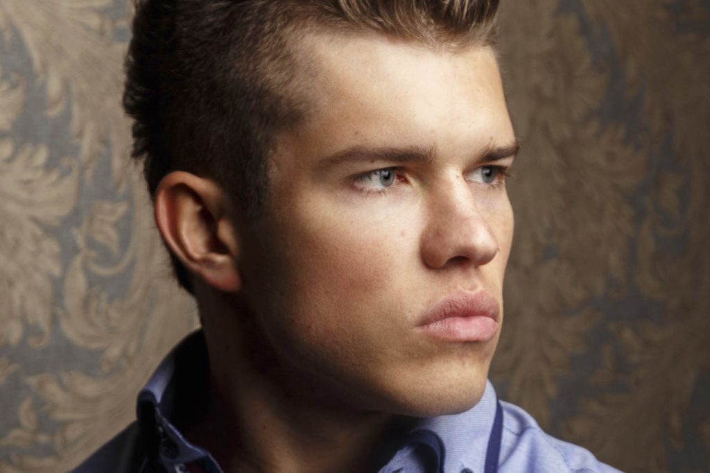 Aumento de pomulos Clinica Medicina Estetica Dr Elena Berezo