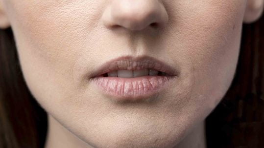 marcacion mandibular