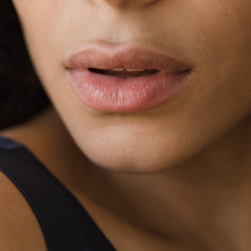 aumento de labios en la clínica medicina estética EB