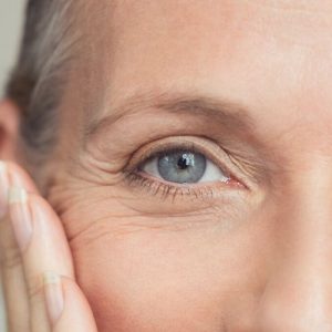 eliminar patas de gallo