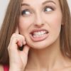 bruxismo en la clínica de medicina estética