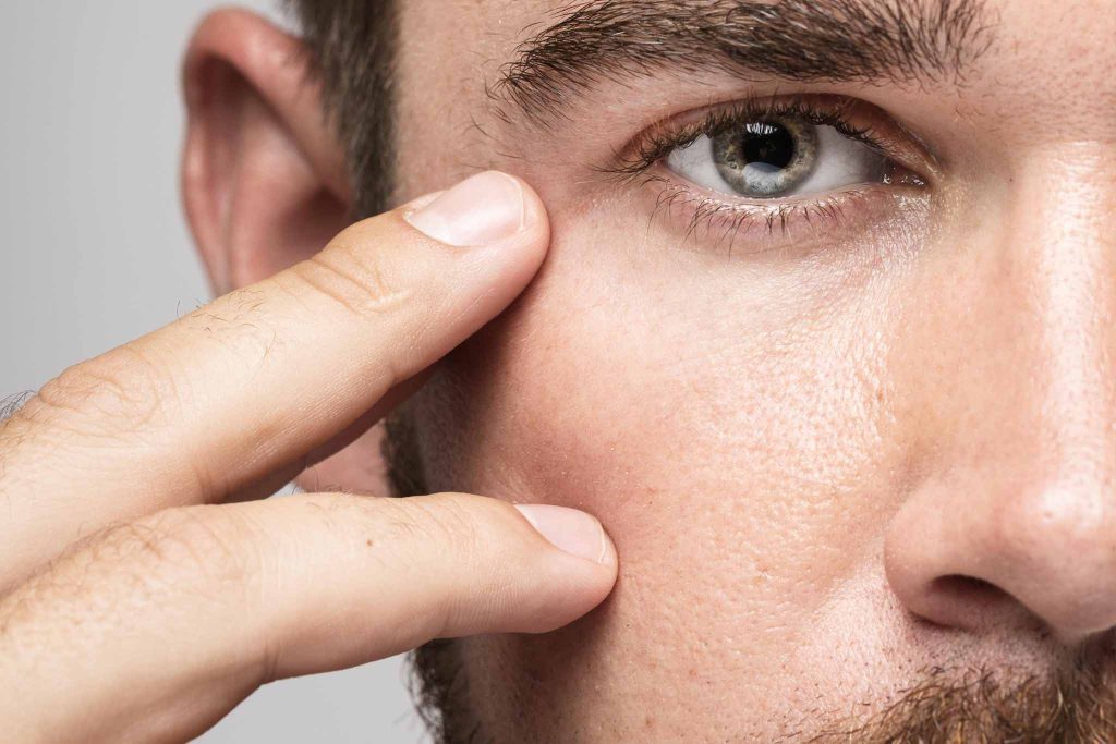 Aumento Pómulos Hombre Dra Elena Berezo