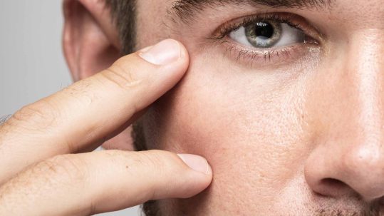 aumento de pomulos hombre