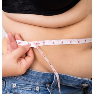 liposucción sin cirugía Madrid