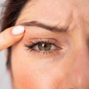 eliminar las ojeras y bolsas de los ojos con medicina estética