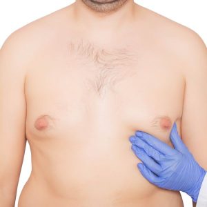 importancia de abordar la grasa pectoral en el hombre