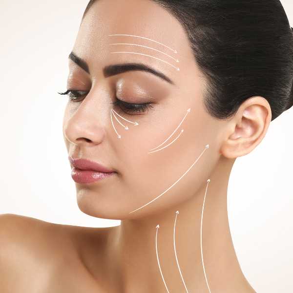 hilos tensores para el tratamiento de lifting facial sin cirugía