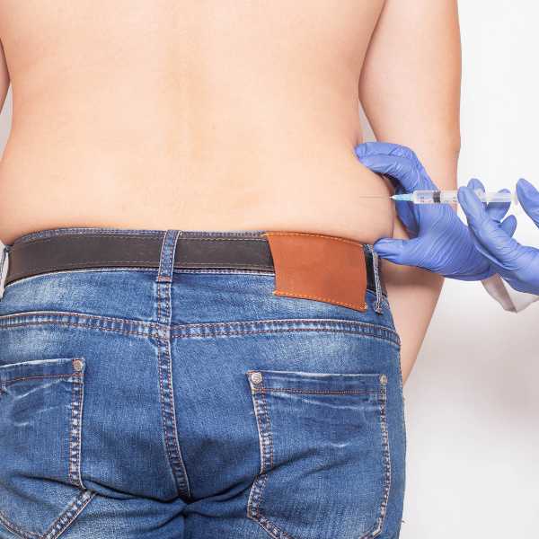 liposuccion sin cirugia eliminar grasa espalda en la clínica de medicina estética Dra Elena Berezo