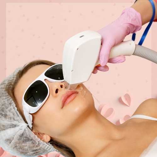 promoción san valentín 2024 resurfacing láser facial en la clínica de medicina estetica EB, dirigida por la Dra Elena Berezo