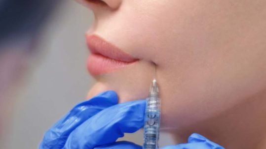 radiesse clínica medicina estética EB madrid