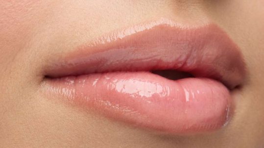 hidratación labios sin aumento con acido hialuronico Clinica Medicina Estetica EB