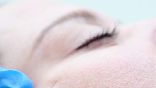 aumento de pómulos en Madrid, clínica de medicina estetica IME