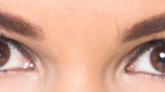 eliminar arrugas debajo de los ojos