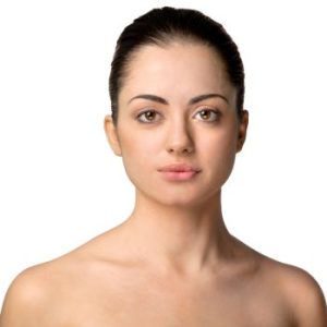 eliminar ojeras y bolsas con acido hialuronico en la clinica de medicina estetica EB en Madrid