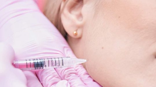 aumento de pomulos o relleno de pomulos con acido hialuronico