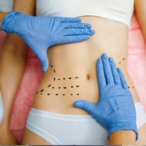 quitar grasa localizada abdomen con coolsculpting elite quitar grasa localizada abdomen con coolsculpting elite