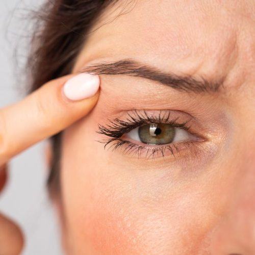 blefaroplastia antes y después en la clinica de medicina estetica EB blefaroplastia antes y después en la clinica de medicina estetica EB