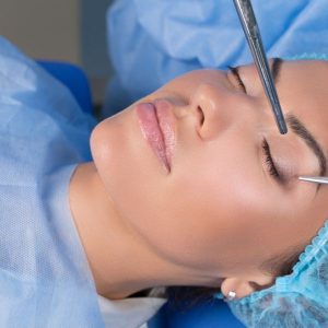 blefaroplastia o cirugia de párpado en madrid. Clinica de medicina Estetica EB