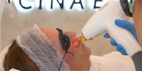 rejuvenecimiento facial clinica medicina estetica