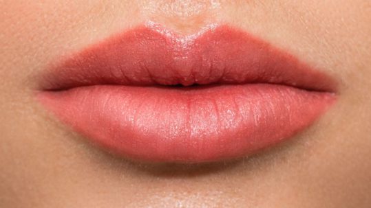 labios de arco cupido cona ácido hialuronico