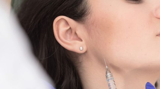 marcar mandibula en la clinica de medicina estetica eb