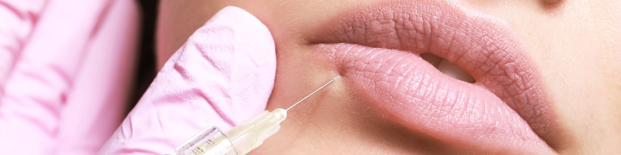 pinchar labios con acido hialuronico