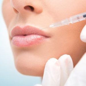 Tratamiento pinchar labios con acido hialuronico Tratamiento pinchar labios con acido hialuronico