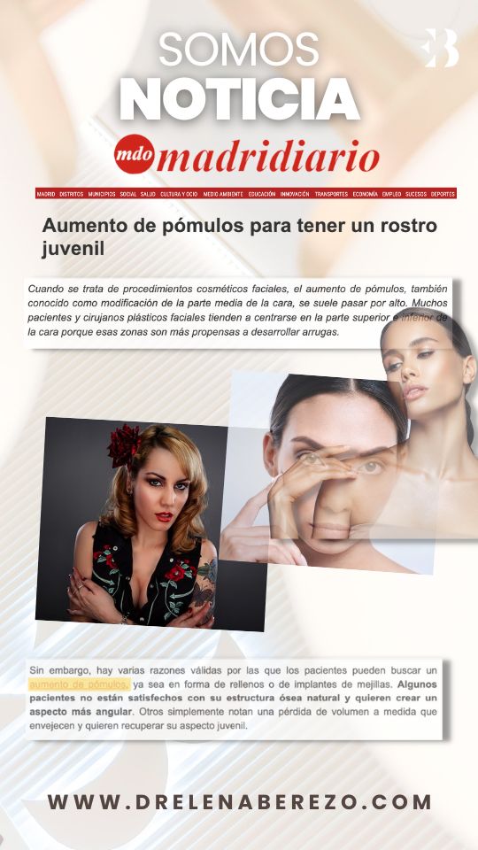 Aumento Pómulos en Madrid diario con la Dra Elena Berezo somos noticias