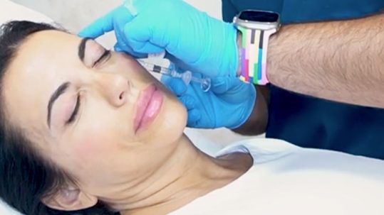 Bioestimuladores de colágeno en las Clínicas de Medicina Estética EB