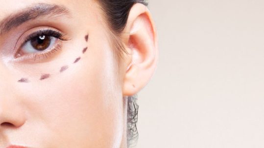 mejor tratamiento para eliminar las ojeras