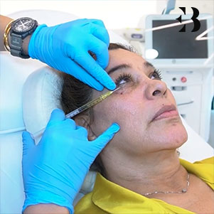 Eliminar ojeras paciente Clinica EB