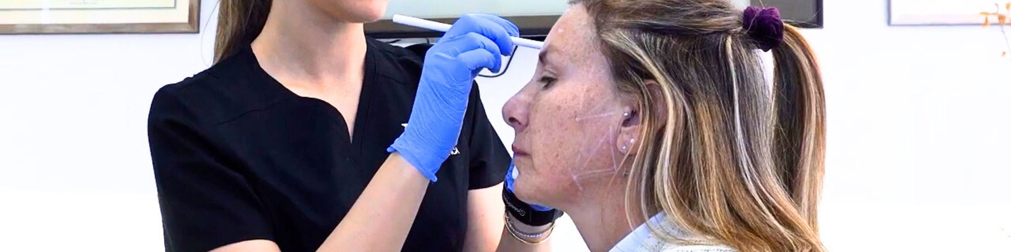 Hidroxiapatita Cálcica Radiesse