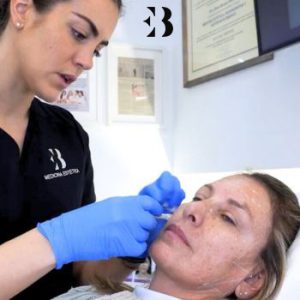 hidroxiapatita cálcica tratamiento Radiesse