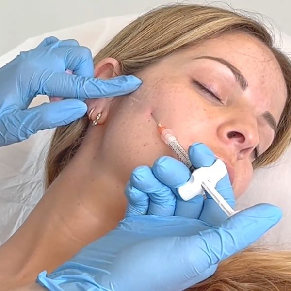 Tratamiento Estimulador Colágeno Paciente Clinica EB