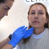 Sculptra- Tratamiento Inductor de Colágeno Paciente Clinica EB