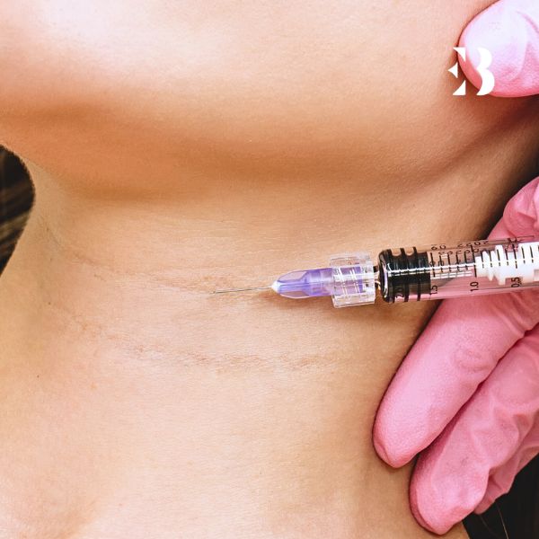 inductor colágeno en Salamanca para el tratamiento cuello en la clinica de medicina estetica EB