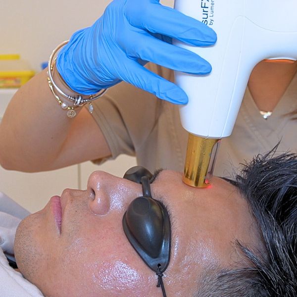 Resurfacing - Laser Facial para eliminar arrugas frente. Paciente Clinica EB