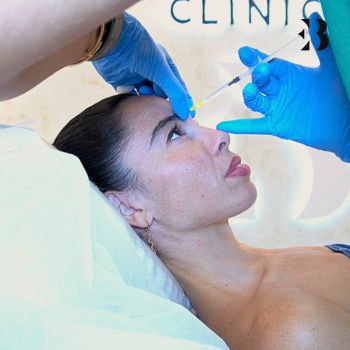 Macarena se realiza el tratamiento para atenuar las arrugas en frente en la Clínica EB