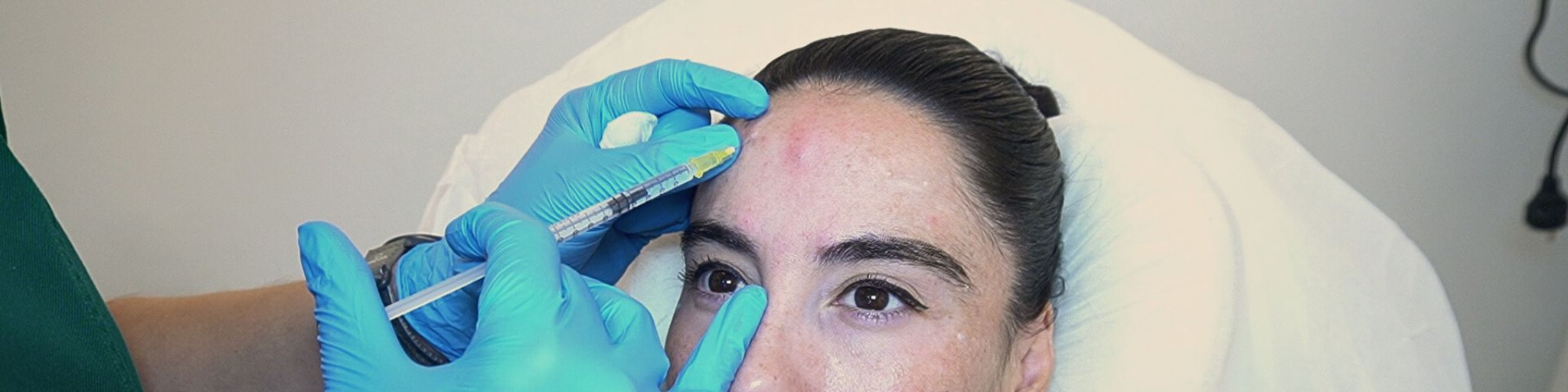 Macarena se realiza el tratamiento eliminar arrugas frente en clinica EB