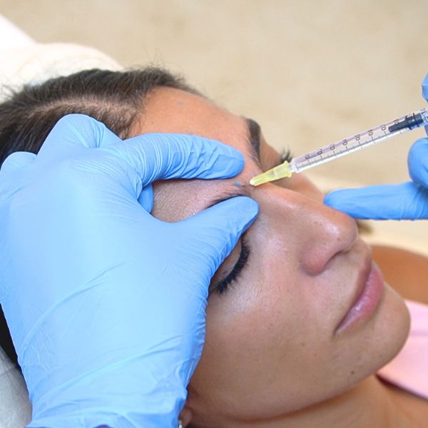 tratamiento eliminar arrugas botox Alma Cortes clinica EB