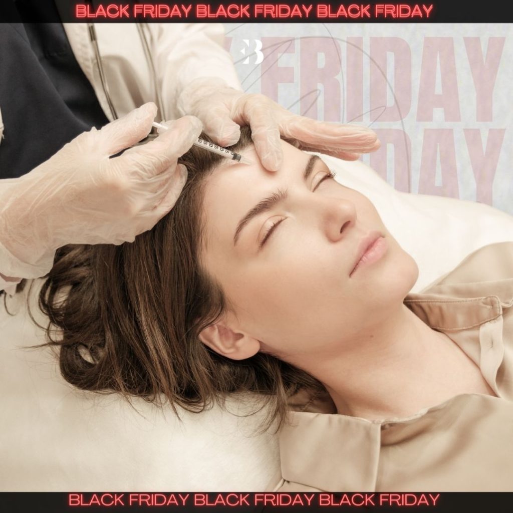 arrugas con botox en la clinica de medicina estetica EB