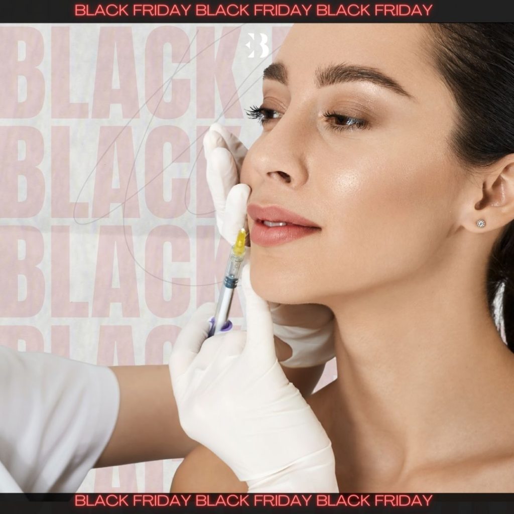 aumento labios con acido hialurónico. Clinica de Medicina Estetica EB