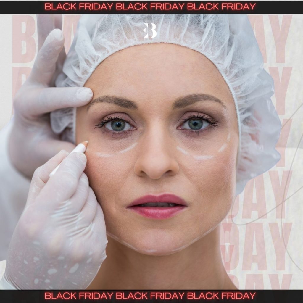 ojeras acido hialurónico