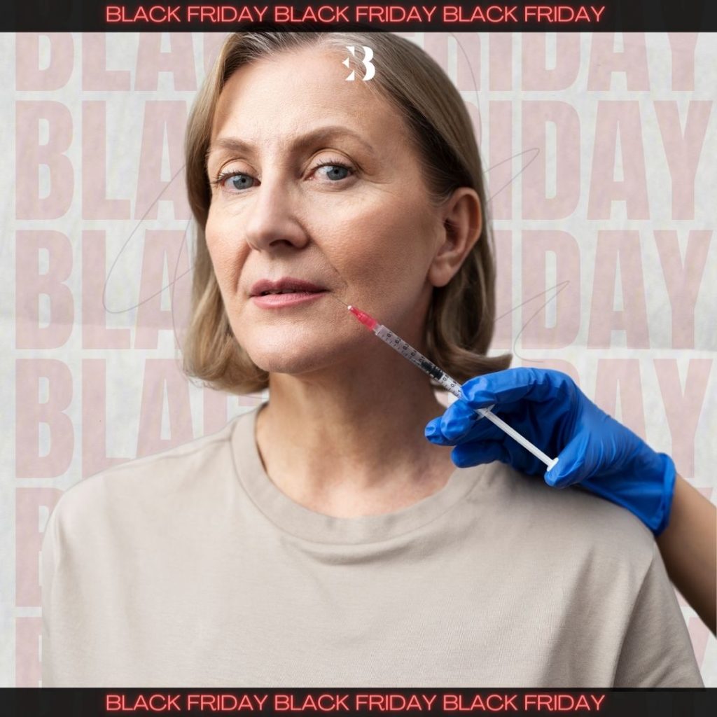 surco nasogeniano con acido hialuronico en la clinica de medicina estetica en EB