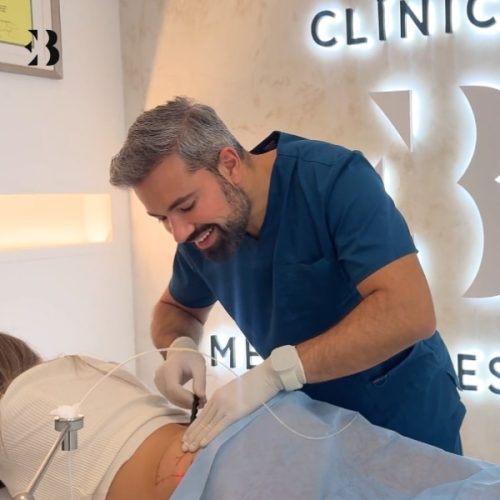 lipolaser madrid opiniones